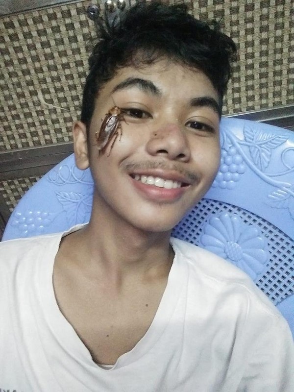 Dân mạng rần rần bắt trend đặt gián lên mặt khiến người xem sởn da gà