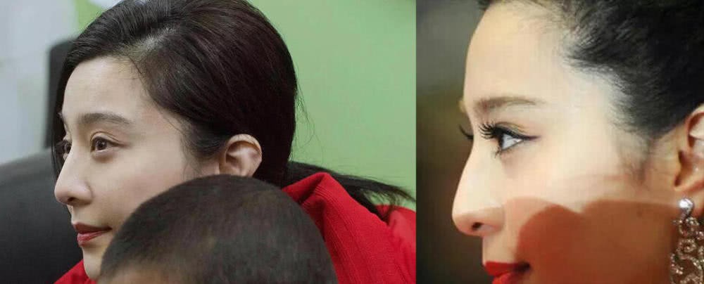 Tự hào là nữ hoàng không động chạm dao kéo, giờ đây Phạm Băng Băng phải sửa mũi để đổi vận sau scandal?