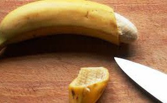 Cắt bao quy đầu có ảnh hưởng chuyện ấy?