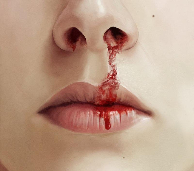 Nghe thì có vẻ đơn giản nhưng bạn hoàn toàn có thể sẽ bị điếc chỉ vì... xì mũi