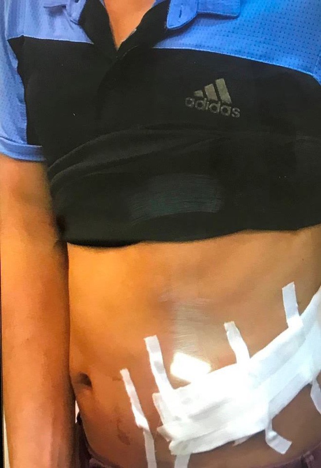 Tìm kiếm nạn nhân bán thận để điều tra đường dây buôn bán nội tạng xuyên quốc gia khủng