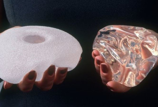 Nâng ngực có thể khiến bạn nhận cái kết đắng: Trước khi làm hãy nhớ nguyên tắc sống còn này