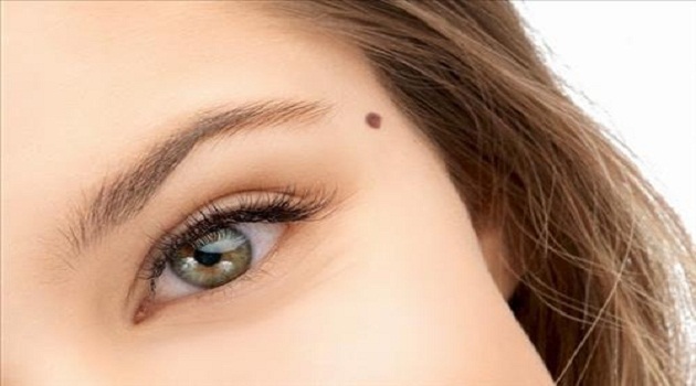 5 nốt ruồi quyết định đường tình duyên của phụ nữ: Số 1 nhớ để lại còn số 3 nên xóa 5 nốt ruồi quyết định đường tình duyên của phụ nữ: Số 1 nhớ để lại còn số 3 nên xóa