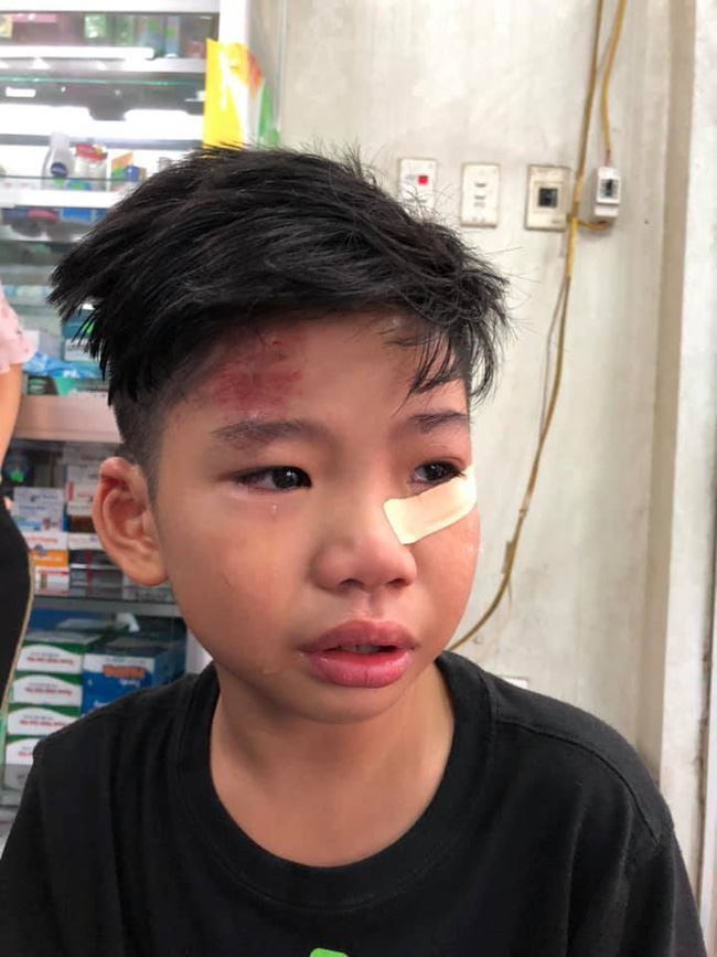 Hai con nhỏ của siêu mẫu Hạ Vy bị xe điên tông chấn thương não rồi bỏ chạy