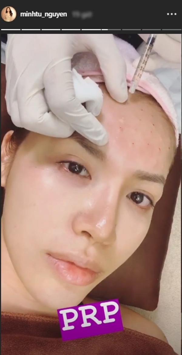 Sững người trước kết quả dương tính với HIV sau thẩm mỹ, đã có 1 trường hợp tại Việt Nam