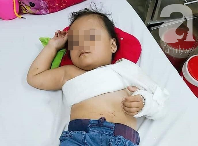 Chở con gái đi thăm ông ngoại bệnh nặng, người mẹ đâm đầu vào trụ đèn, phải bỏ một bên mắt