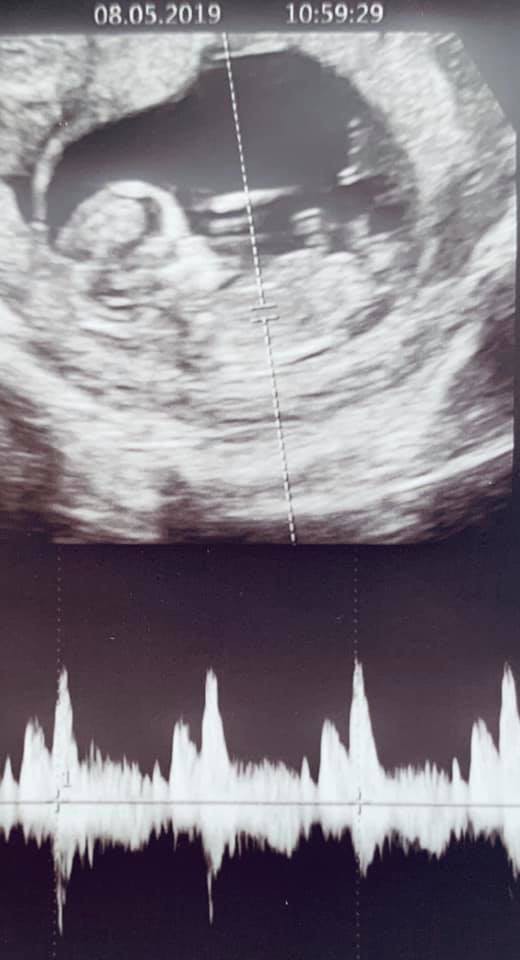 John Tuấn Nguyễn xác nhận bà xã Lan Khuê đang mang thai con đầu lòng sau hơn 7 tháng kết hôn