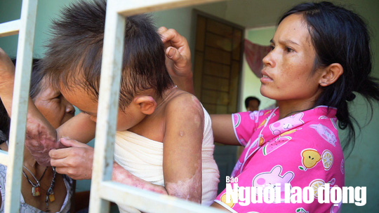 Bác sĩ năn nỉ xin cứu bé 9 tuổi, gia đình quyết từ chối