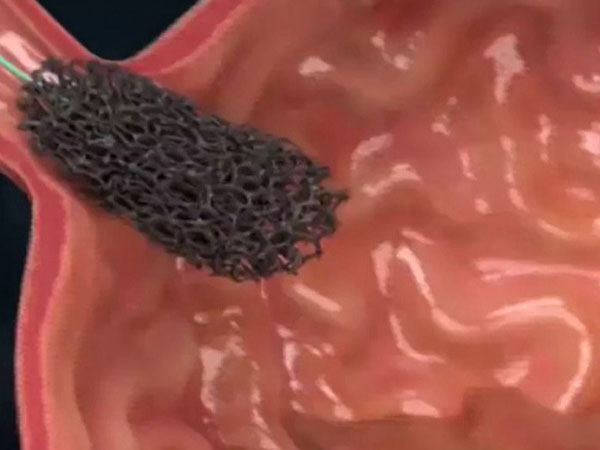 Bệnh nhân ở Hà Nội 16 tuổi đã ung thư vòm họng: Nghi ngờ thủ phạm là thứ người Việt rất mê