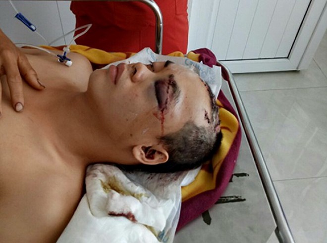 Truy lùng hung thủ chém người, cướp tài sản giữa ban ngày