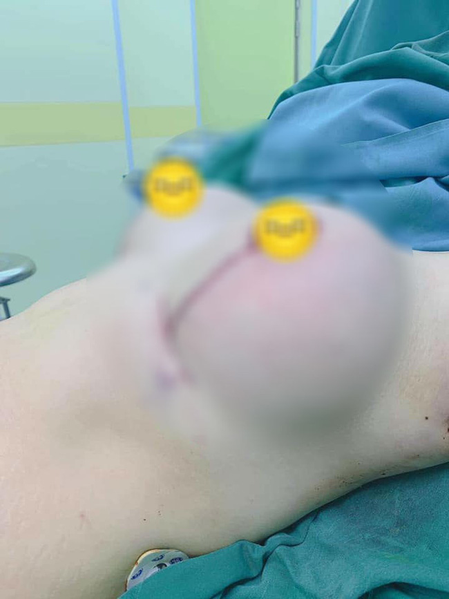 Bức ảnh bộ ngực chảy xệ vì sinh con xuất hiện đúng Ngày của mẹ khiến hội chị em xót xa, vài giờ sau đó có điều gây bất ngờ