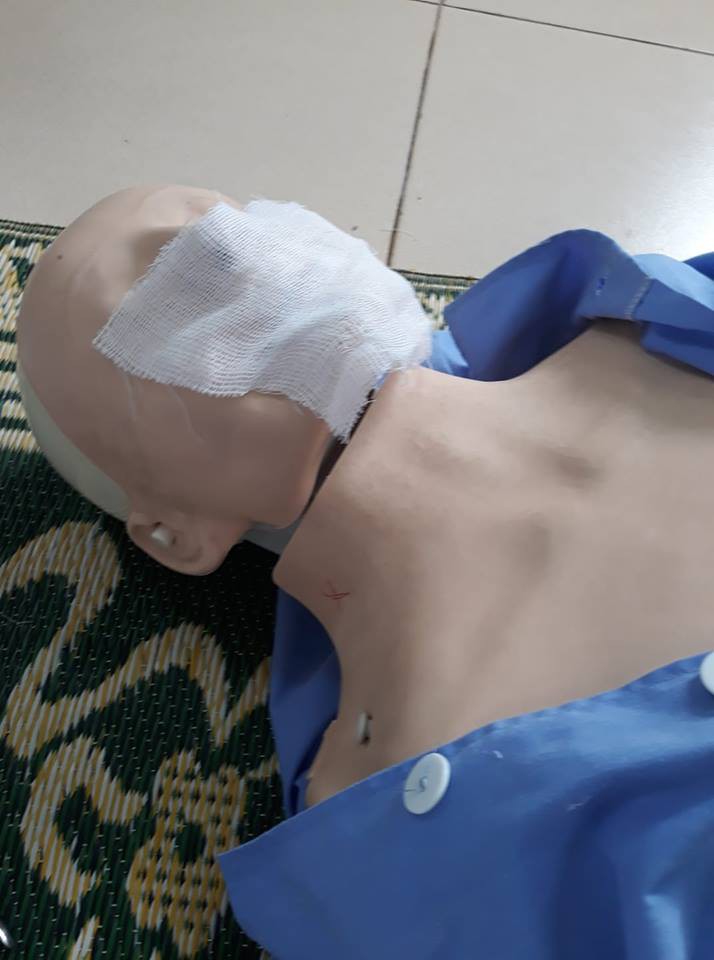 Dở khóc dở cười cảnh sinh viên trường Y xếp hàng quấn băng cho nhau, hở chỗ nào là quấn chỗ đấy!