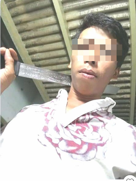 Xót xa người mẹ cầu cứu vì con gái 6 tuổi bị cha ruột hành hạ dã man