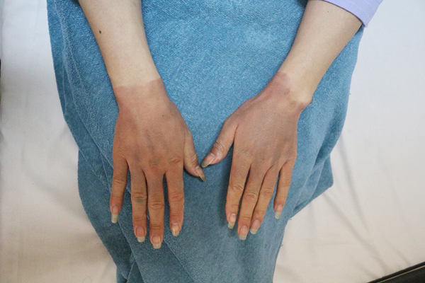 Dùng bật lửa đốt dây bóng tại chùa Ba Vàng, 4 người bị bỏng Dùng bật lửa đốt dây bóng tại chùa Ba Vàng, 4 người bị bỏng