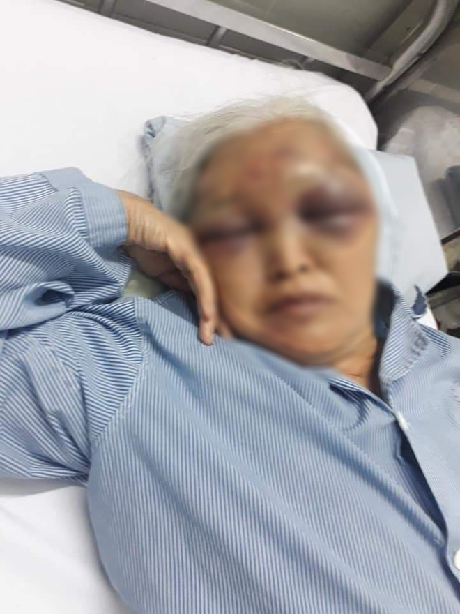 Hà Nội: Đến thăm con vào giữa đêm không được đồng ý, rể cũ ra tay đánh mẹ vợ nhập viện