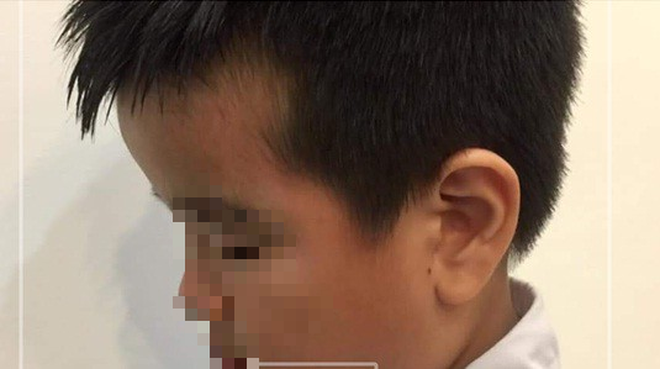 Mẹ nam sinh lớp 2 ở Hải Phòng đăng clip cô giáo tát tới tấp con mình, dùng thước vụt mạnh nhiều em khác