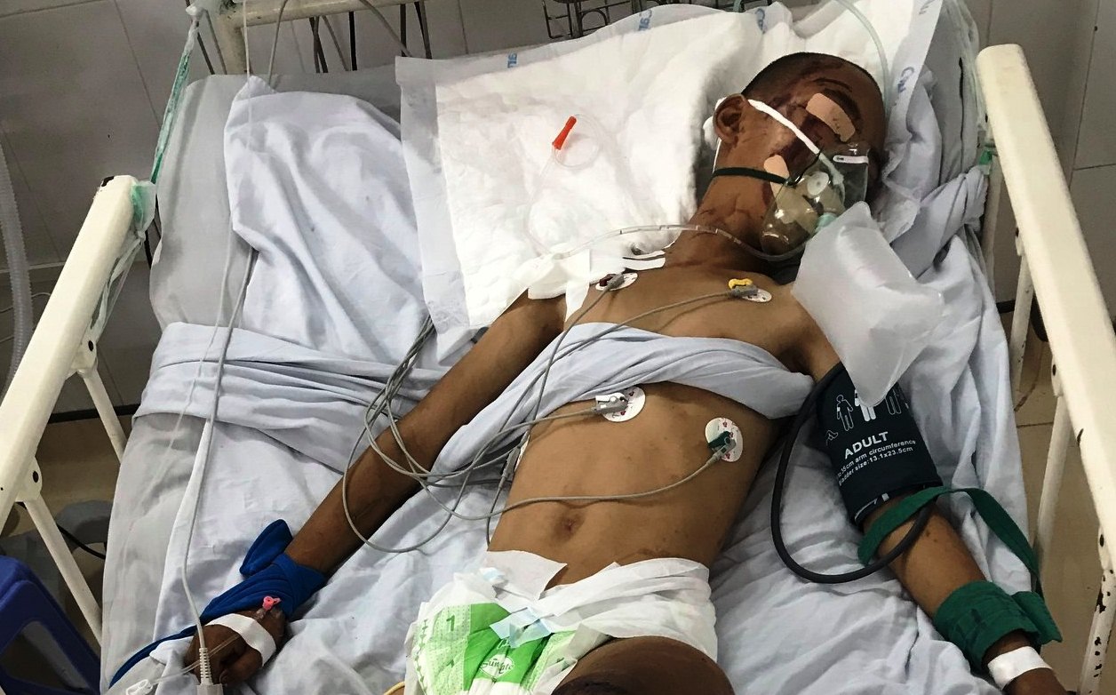 Cậu bé mồ côi bị tai nạn giao thông nguy kịch, kẻ gây tai nạn bỏ chạy