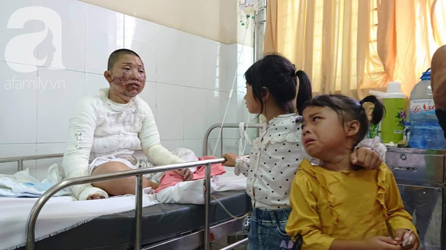 Bố dùng xăng đốt khiến mẹ biến dạng khuôn mặt, con gái 8 tuổi khóc ngất: Mẹ có xấu nhưng con vẫn nhận ra mẹ mà