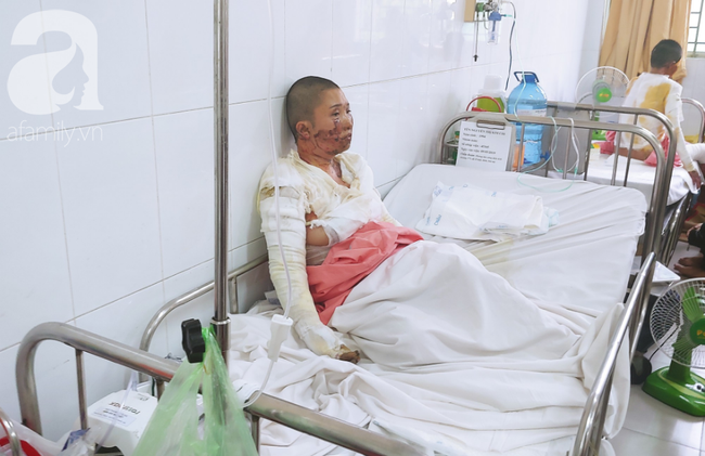 Bố dùng xăng đốt khiến mẹ biến dạng khuôn mặt, con gái 8 tuổi khóc ngất: Mẹ có xấu nhưng con vẫn nhận ra mẹ mà