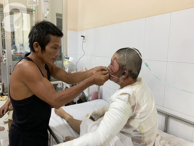 Bố dùng xăng đốt khiến mẹ biến dạng khuôn mặt, con gái 8 tuổi khóc ngất: Mẹ có xấu nhưng con vẫn nhận ra mẹ mà