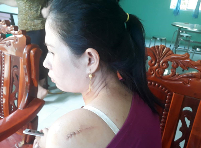 Phút kinh hoàng của cô dâu bị chồng cũ rượt chém tại tiệc cưới