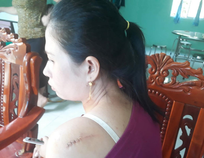 Người chém cô dâu tại tiệc cưới từng dọa xẻo tai chú rể