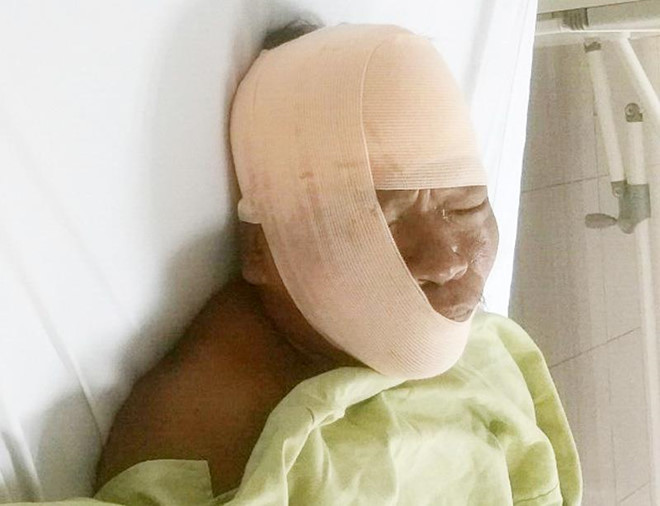 Người chém cô dâu tại tiệc cưới từng dọa xẻo tai chú rể