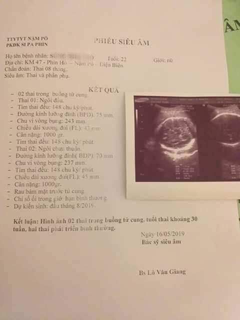 Người phụ nữ có biểu hiện mắc bệnh tâm thần mang thai đôi 8 tháng, nghi bị hiếp dâm