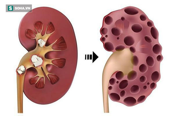 Người có chức năng thận kém nên ăn 4 thực phẩm này: Vừa lành vừa bổ thận tráng dương