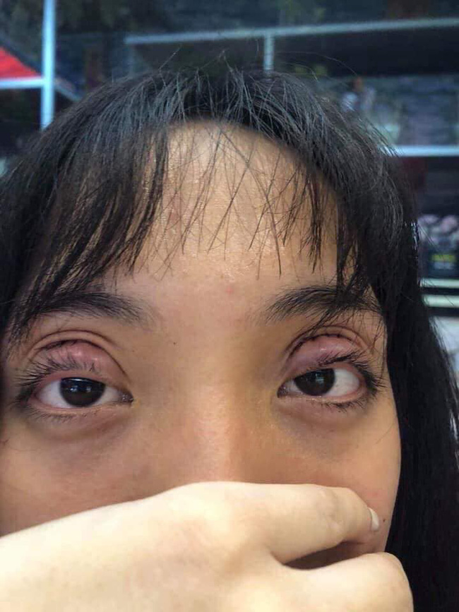 Đã mất tiền lại còn biến lợn lành thành lợn què, chị gái trẻ hối hận vạn phần khi nhấn mí còn cộng đồng mạng thì rùng mình