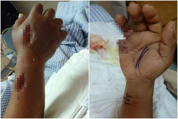 2 người phụ nữ tử vong sau khi ăn hải sản: Hãy cẩn trọng và đừng bao giờ ăn hải sản kiểu này - 1 2 người phụ nữ tử vong sau khi ăn hải sản: Hãy cẩn trọng và đừng bao giờ ăn hải sản kiểu này - 1