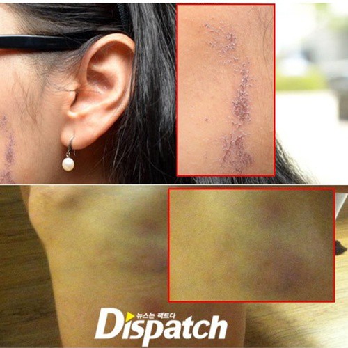 Kết cục dành cho 5 sao nam Hàn đánh phụ nữ: Kẻ lĩnh án tù, người cuối gây sốc nhất lại hạnh phúc viên mãn