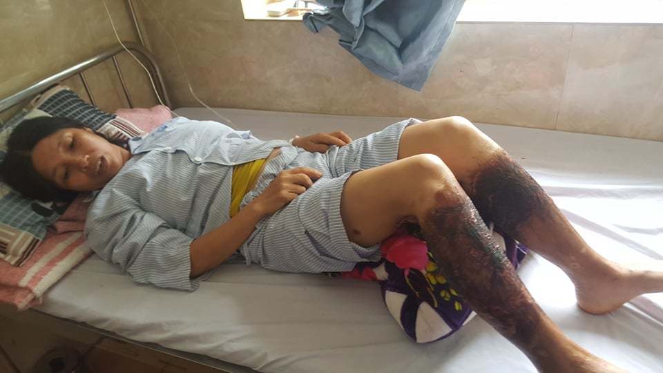 Người phụ nữ Hải Phòng bắt cua bị bỏng chân: Thêm điểm đổ chất thải độc