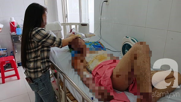 Thương tâm: Chuẩn bị ăn cơm thì nổ bình gas, cả gia đình 4 người bỏng nặng