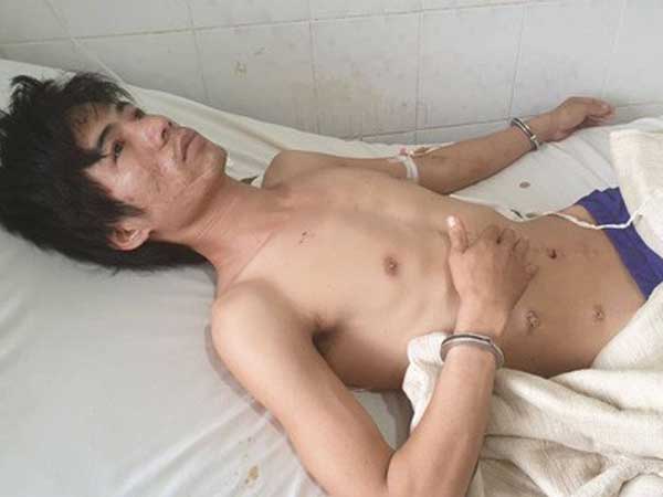 Vừa mổ xong, trốn viện đi… cướp!