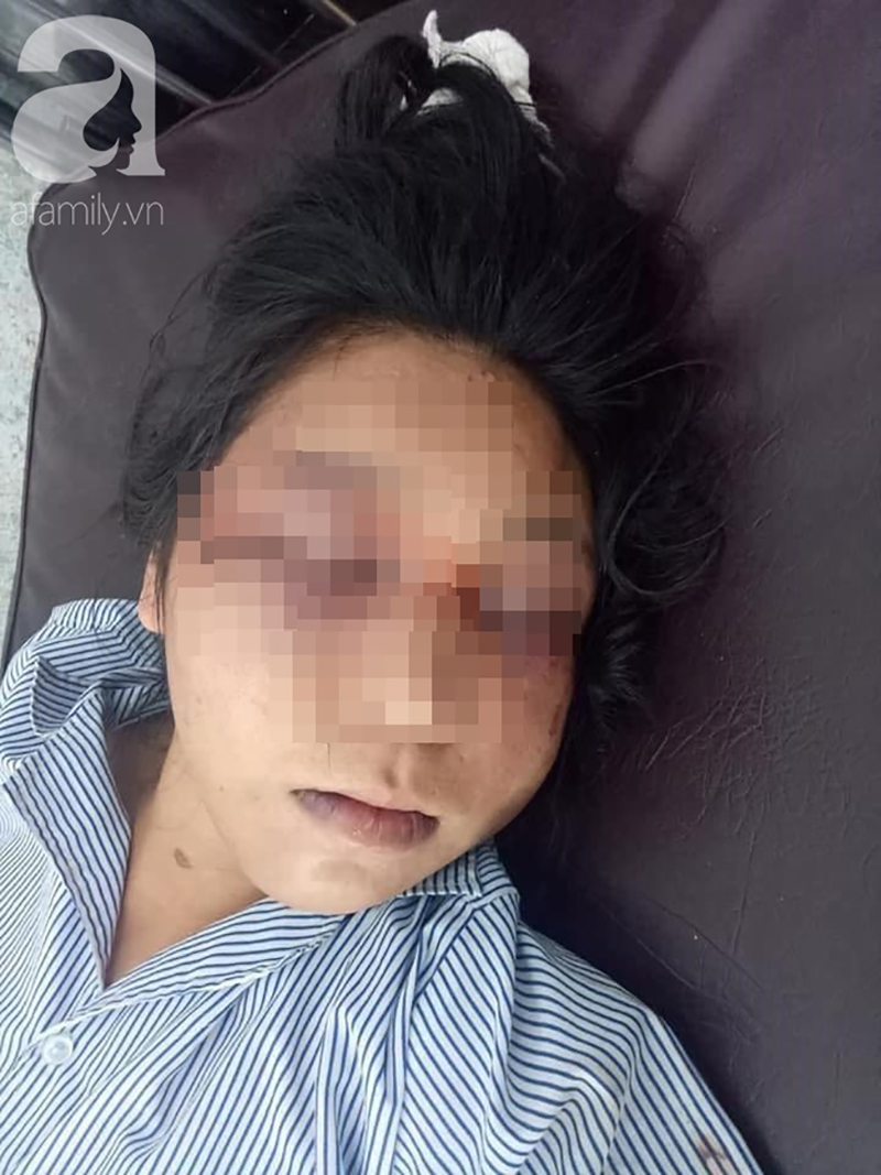 Chồng nhậu say, đánh vợ đang mang bầu 3 tháng tàn nhẫn: Tôi thấy có người nắm tay cô ấy nên không kìm chế được...