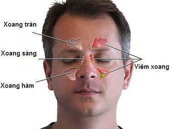 Bệnh ung thư ăn vào não có dấu hiệu chỉ từ đau đầu, nhìn kém