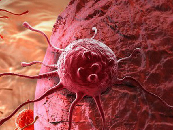 Vì sao tế bào ung thư lan nhanh bất thường?