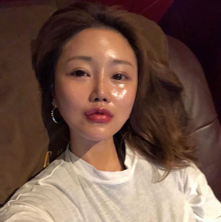 Chẳng thể nhận ra bà trùm của để chế Style Nanda và 3CE vì mặt đơ, môi tều đến biến dạng do thẩm mỹ quá đà