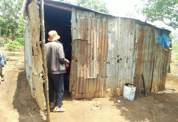 Bé trai 5 tuổi sống trong ngôi nhà 8m2 bị tụt não xuống mũi