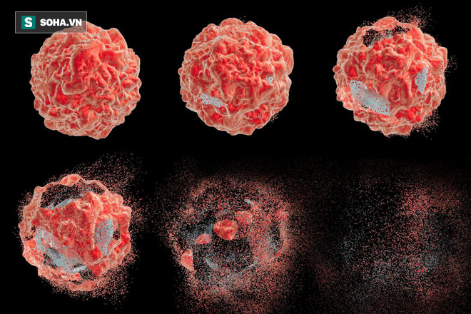 Ai tránh được 6 việc này thì ít mắc ung thư: Hãy nhớ bệnh lớn bắt đầu từ thói quen nhỏ