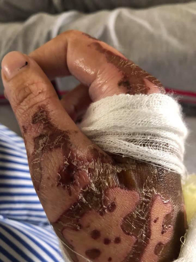 Bố của cô gái bị chồng sắp cưới tạt axit biến dạng gương mặt: Nó làm thế còn đau đớn hơn giết người