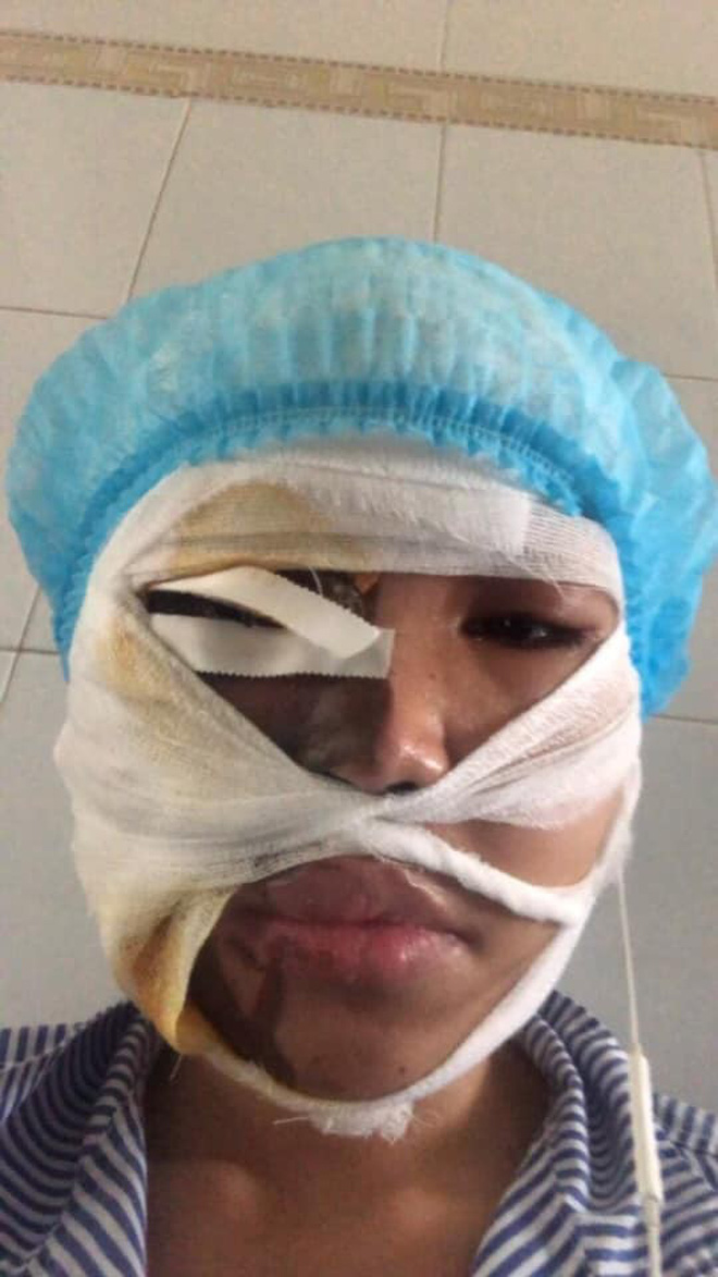 Bố của cô gái bị chồng sắp cưới tạt axit biến dạng gương mặt: Nó làm thế còn đau đớn hơn giết người