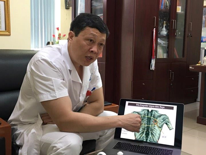 Vụ cô gái bị tạt axit: Bác sĩ ám ảnh vì một nửa khuôn mặt cháy đen