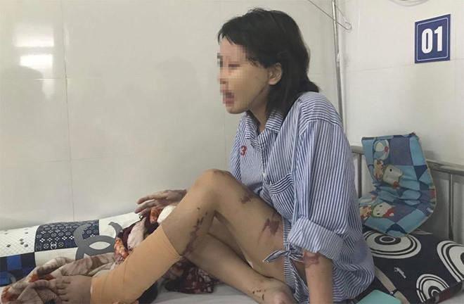 Vụ cô gái bị tạt axit: Bác sĩ ám ảnh vì một nửa khuôn mặt cháy đen