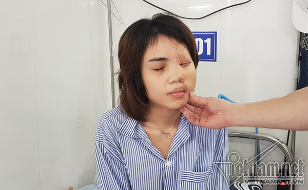 Bác sĩ kể lại hành trình hồi sinh gương mặt xinh đẹp cho cô gái bị thiếu úy tạt axit