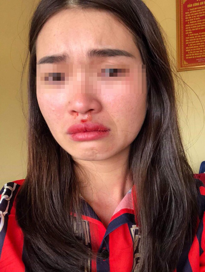 Thông tin mới vụ tài xế xe buýt đánh nữ hành khách chảy máu mũi vì chụp ảnh xe đánh võng