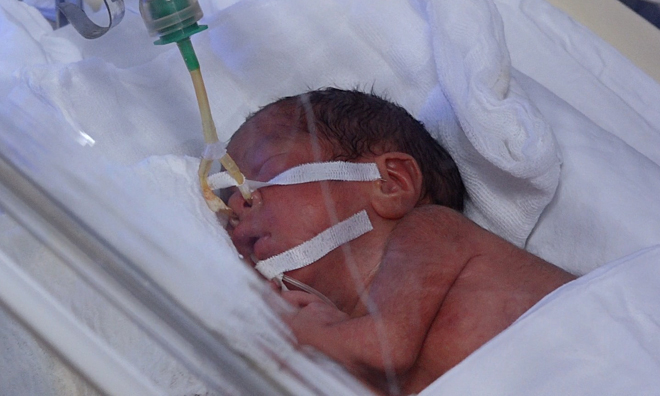 Sản phụ ung thư tỉnh lại, giao tiếp bằng viết chữ