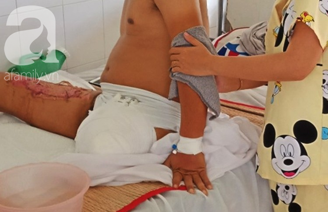Đi làm thuê để lo cho vợ sắp sinh, chồng bị tai nạn nguy kịch phải cắt bỏ 1 chân