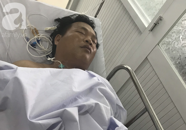 Đi làm thuê để lo cho vợ sắp sinh, chồng bị tai nạn nguy kịch phải cắt bỏ 1 chân